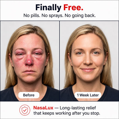 Red Light Therapy Nasal Device for Allergy & Congestion Relief